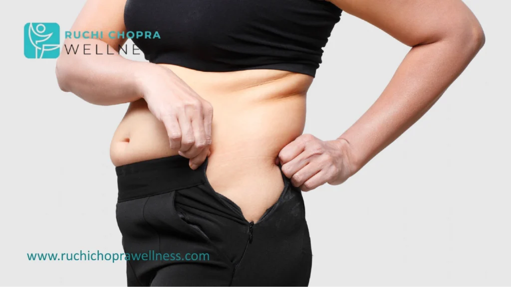 Managing pcos weight gain even with exercise requires a tailored approach.
