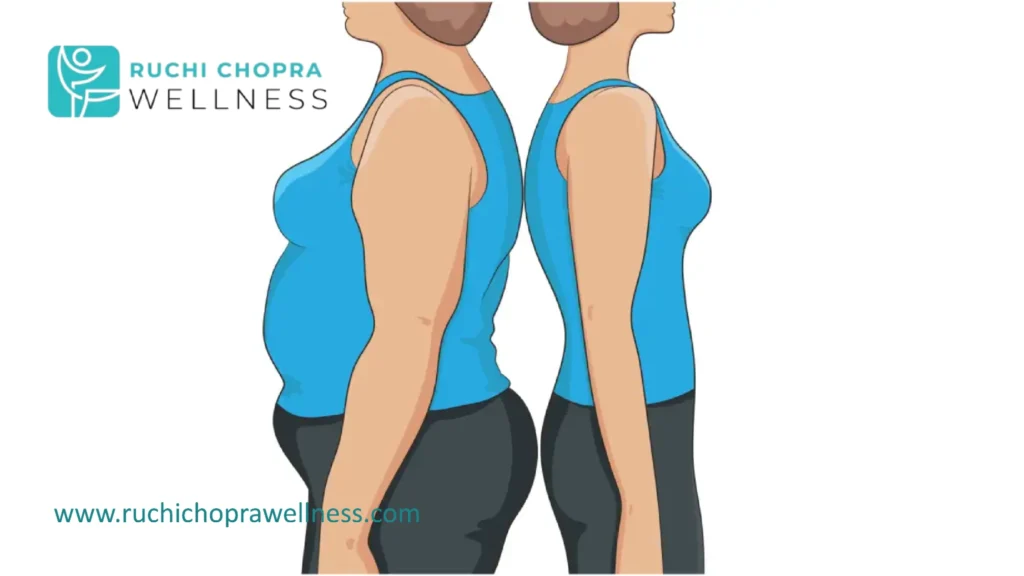Understanding types helps manage pcos keep gaining weight better.
