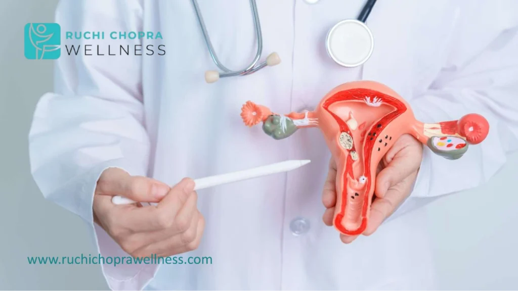 Widespread pcos weight gain with exercise affects many women.
