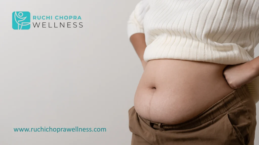 Yes, can you have pcos and not gain weight as it varies for every woman.